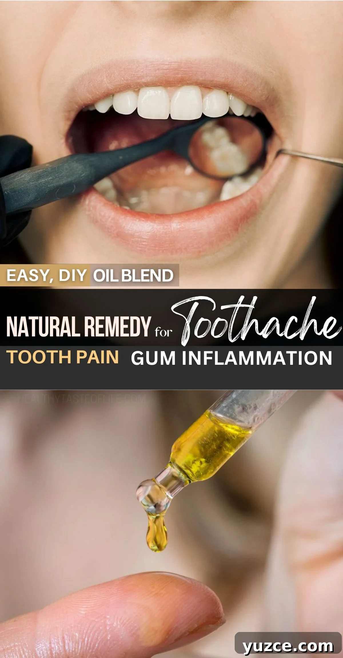 DIY Essential Oil Blend for Toothache Relief and Pain Care 14 This blend of oils for toothache is a great all-natural home remedy to relieve dental pain and gum inflammation. This DIY oil is great for stopping a toothache whether is dull or throbbing and bring pain relief in minutes. Oils for tooth pain, inflammation; natural home remedy for tooth pain relief, natural antibiotic for toothache and infection. #toothache #painrelief #naturalremedy #toothpain #naturalremedy