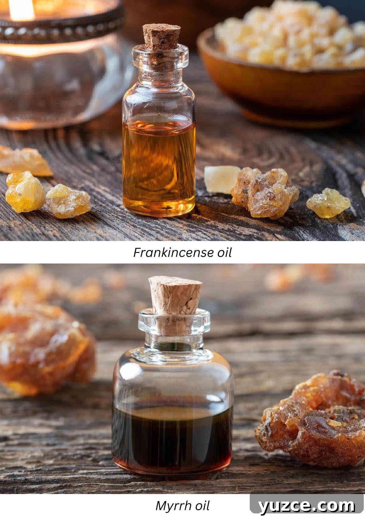 DIY Essential Oil Blend for Toothache Relief and Pain Care 8 Frankincense oil and myrrh oil for toothache pain inflammation.